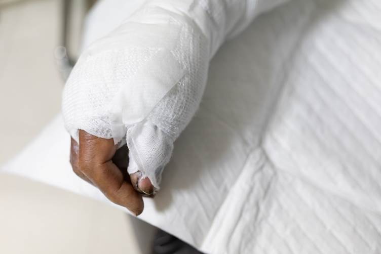 The Long-Term Effects of Burn Injuries: Seeking Compensation